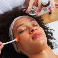 Understanding Chemical Peels: Benefits, Risks, and Choosing the Right Option for You