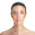 Avoiding Sun Exposure and Harsh Products: Protecting Your Skin Before and After a Chemical Peel