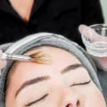 Reduced Signs of Aging: The Benefits and Risks of Chemical Peels