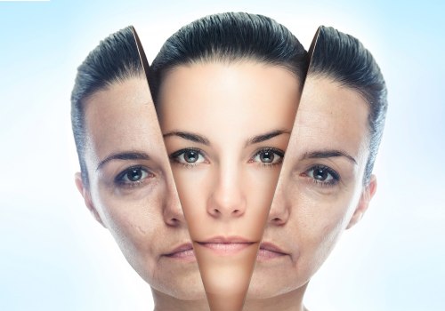 Stronger Formulations for Better Results: Achieving Your Dream Skin