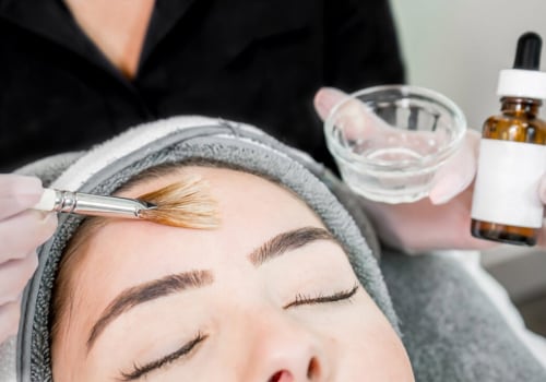 Reduced Signs of Aging: The Benefits and Risks of Chemical Peels