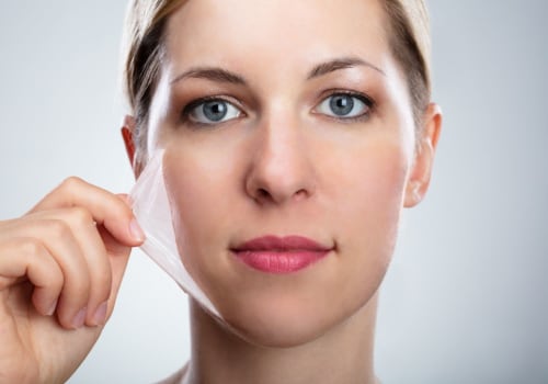 Infection Prevention After a Chemical Peel: What You Need to Know